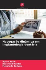 Navegaç?o dinâmica em implantologia dentária