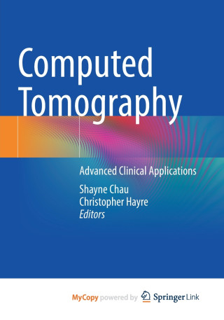 Computed Tomography