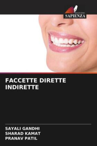 FACCETTE DIRETTE INDIRETTE