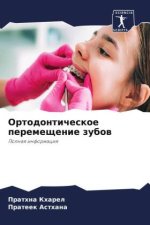 Ortodonticheskoe peremeschenie zubow