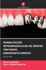 REABILITAÇÃO INTRARRADICULAR DE DENTES TRATADOS ENDODONTICAMENTE