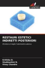 RESTAURI ESTETICI INDIRETTI POSTERIORI