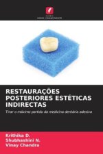 RESTAURAÇ?ES POSTERIORES ESTÉTICAS INDIRECTAS
