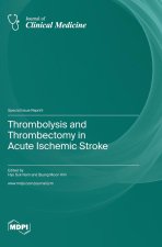 Thrombolysis and Thrombectomy in Acute Ischemic Stroke