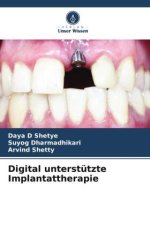 Digital unterstützte Implantattherapie