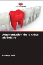 Augmentation de la cr?te alvéolaire