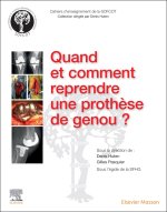 Quand et comment reprendre une prothèse de genou ?
