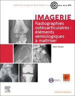 Radiographies ostéoarticulaires : éléments sémiologiques à maitriser