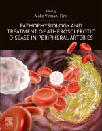 Pathophysiology and Treatment of Atherosclerotic Disease in Peripheral Arteries