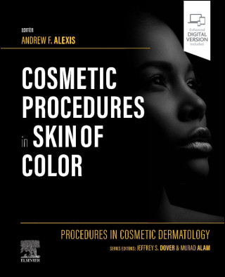 Procedures in Cosmetic Dermatology: Cosmetic Procedures in Skin of Color