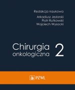 Chirurgia onkologiczna Tom 2