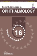 Recent Advances in Ophthalmology - 16