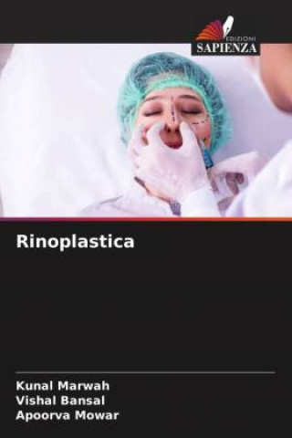 Rinoplastica