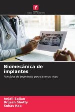Biomecânica de implantes