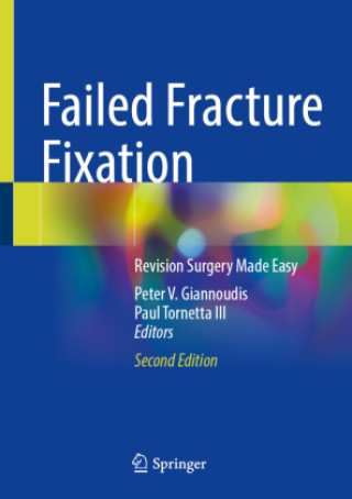 Failed Fracture Fixation