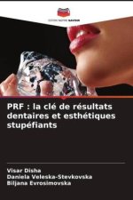 PRF : la clé de résultats dentaires et esthétiques stupéfiants