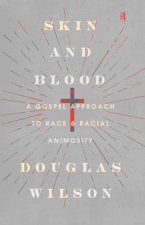 Skin and Blood: A Gospel Approach to Race and Racial Animosity