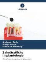 Zahnärztliche Implantologie