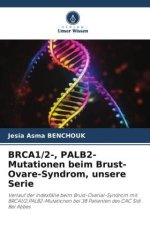 BRCA1/2-, PALB2-Mutationen beim Brust-Ovare-Syndrom, unsere Serie