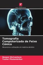 Tomografia Computorizada de Feixe Cónico