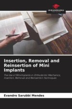 Insertion, Removal and Reinsertion of Mini Implants