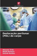 Deslocaç?o perilunar (PDL) do carpo