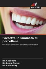 Faccette in laminato di porcellana