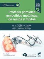 Prótesis parciales removibles metálicas, de resina y mixta (2? edición revisada y actualizada)