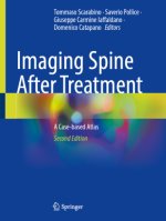 Imaging Spine After Treatment