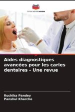Aides diagnostiques avancées pour les caries dentaires - Une revue