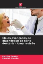Meios avançados de diagnóstico da cárie dentária - Uma revis?o