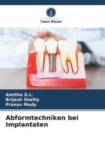 Abformtechniken bei Implantaten