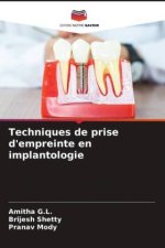 Techniques de prise d'empreinte en implantologie