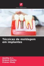Técnicas de moldagem em implantes