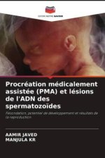 Procréation médicalement assistée (PMA) et lésions de l'ADN des spermatozo?des