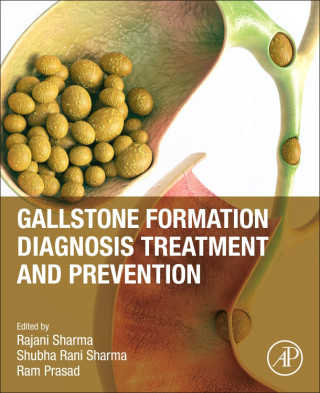 Gallstone formation, diagnosis, treatment & prevention