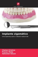 Implante zigomático