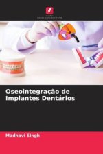 Oseointegraç?o de Implantes Dentários