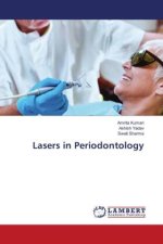 Lasers in Periodontology