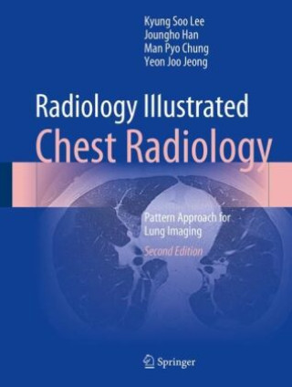 Radiology Illustrated: Chest Radiology (Kyung Soo Lee,Joungho Han,Man Pyo Chung,Yeon Joo Jeong)(Kemény kötésű)
