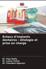 Échecs d?implants dentaires : étiologie et prise en charge