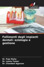 Fallimenti degli impianti dentali: eziologia e gestione