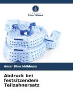 Abdruck bei festsitzendem Teilzahnersatz