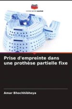 Prise d'empreinte dans une proth?se partielle fixe