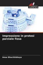 Impressione in protesi parziale fissa