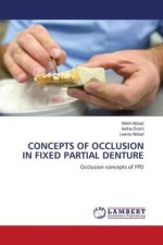 CONCEPTS OF OCCLUSION IN FIXED PARTIAL DENTURE