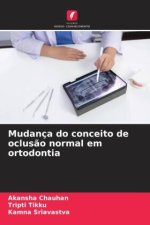 Mudança do conceito de oclus?o normal em ortodontia