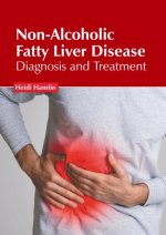 Non-Alcoholic Fatty Liver Disease: Diagnosis and Treatment