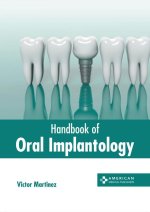 Handbook of Oral Implantology