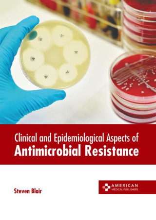 Clinical and Epidemiological Aspects of Antimicrobial Resistance